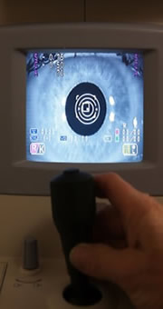 Digital Retinal Photography eye scan at Chelmsford Opticians in Chelmer Village Essex
